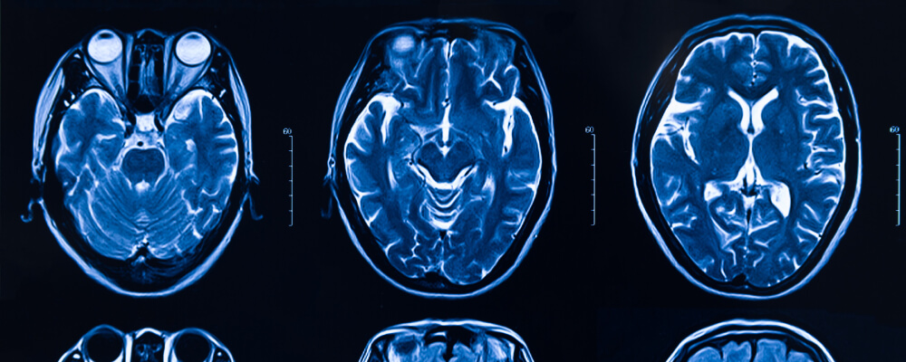 brain injury medical scans