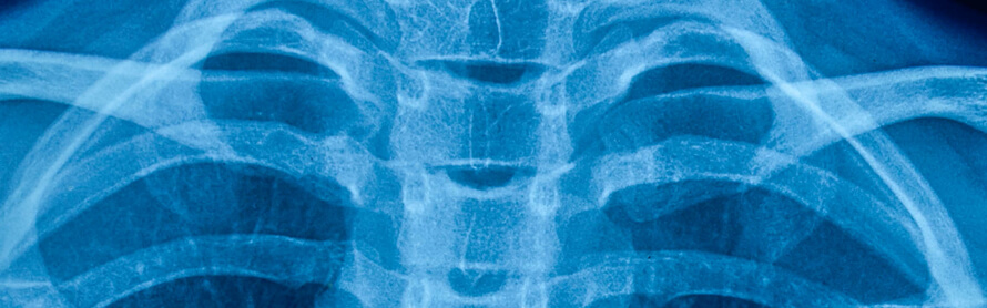 Chicago Neck Injury X-ray